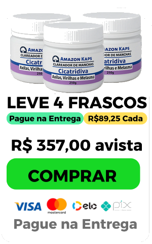 Kit 4 - preço